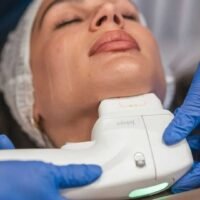 Full Face Laser Hair Reduction Double Chin Reduction