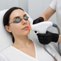 Full Face Laser Hair Reduction Full Face Laser Hair Reduction
