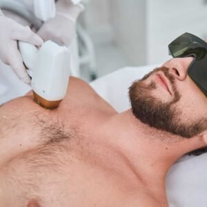 Full Front laser Hair Reduction (Men)